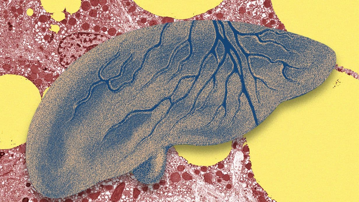 AI Models Use EHRs and Routine X-Rays to Spot