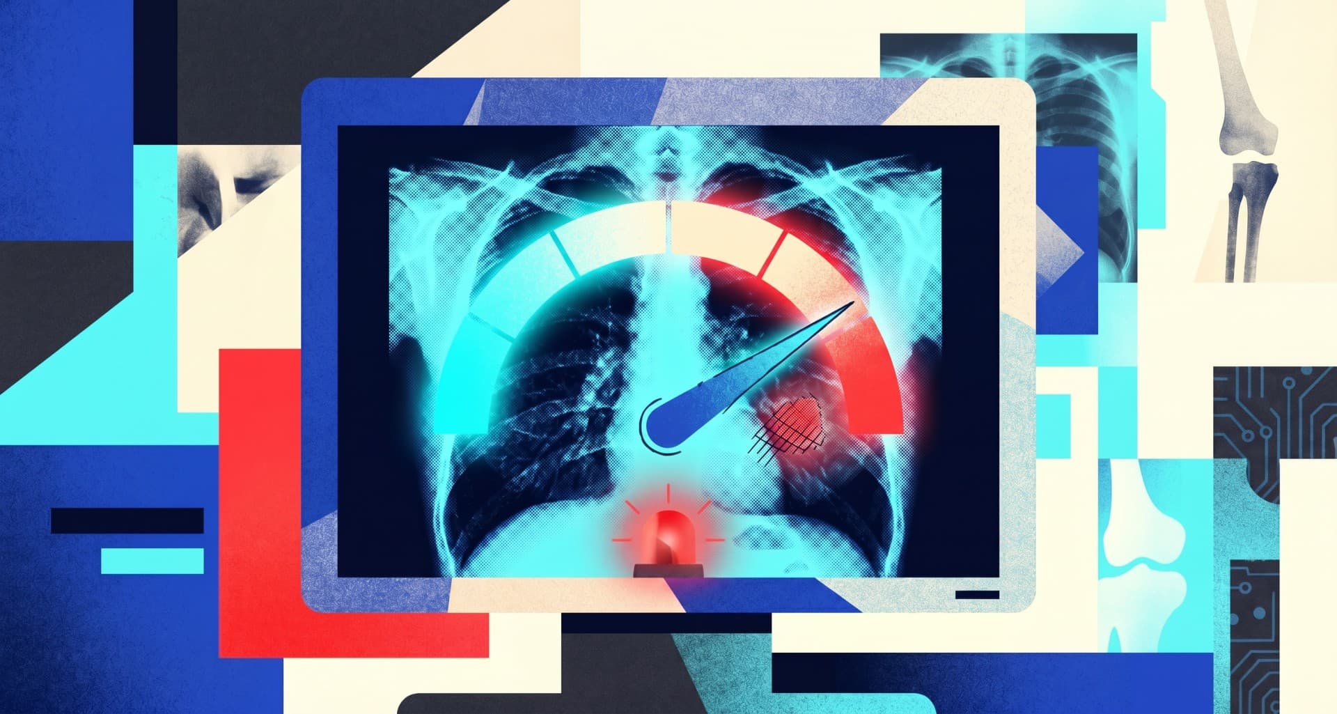 AI chatbots reading X-rays can be dangerously confident even when they're wrong