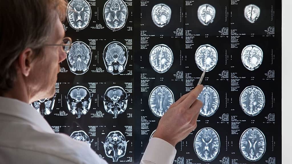 How brain wiring helps some people switch tasks more quickly