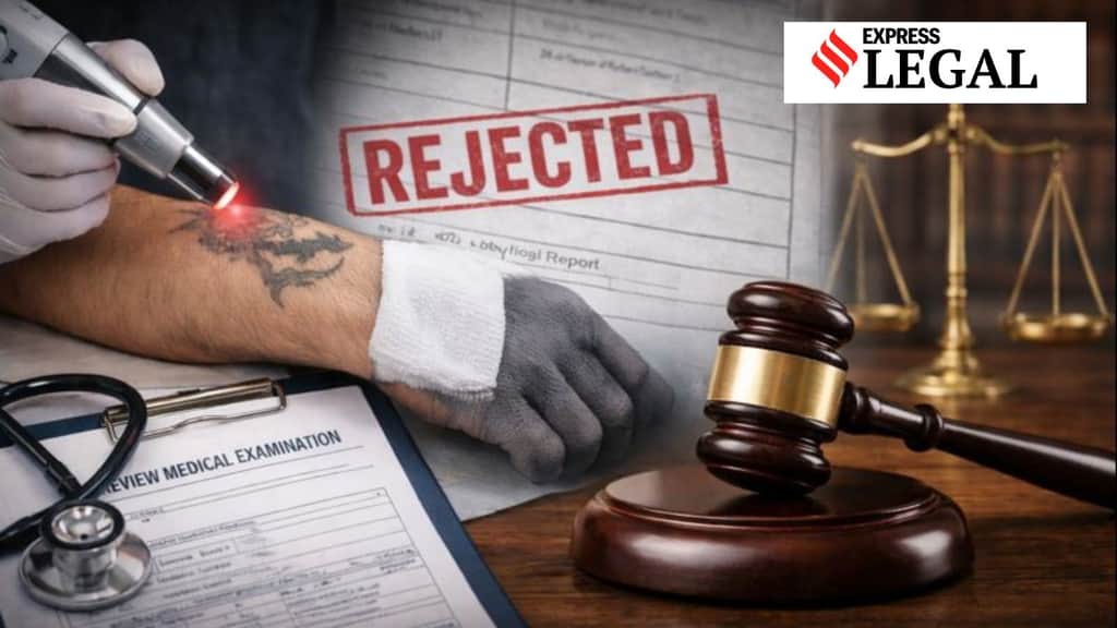 Tattoo removal after medical exam not permissible, rules Calcutta High Court, junks plea of armed forces candidate