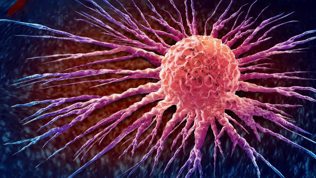 A global cancer surge is underway and the world is not ready