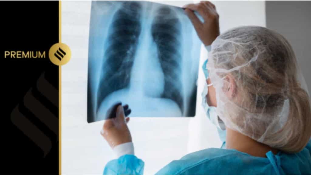 How Chhattisgarh and Puducherry are cutting TB deaths: Food and cash for the undernourished in the first month itself